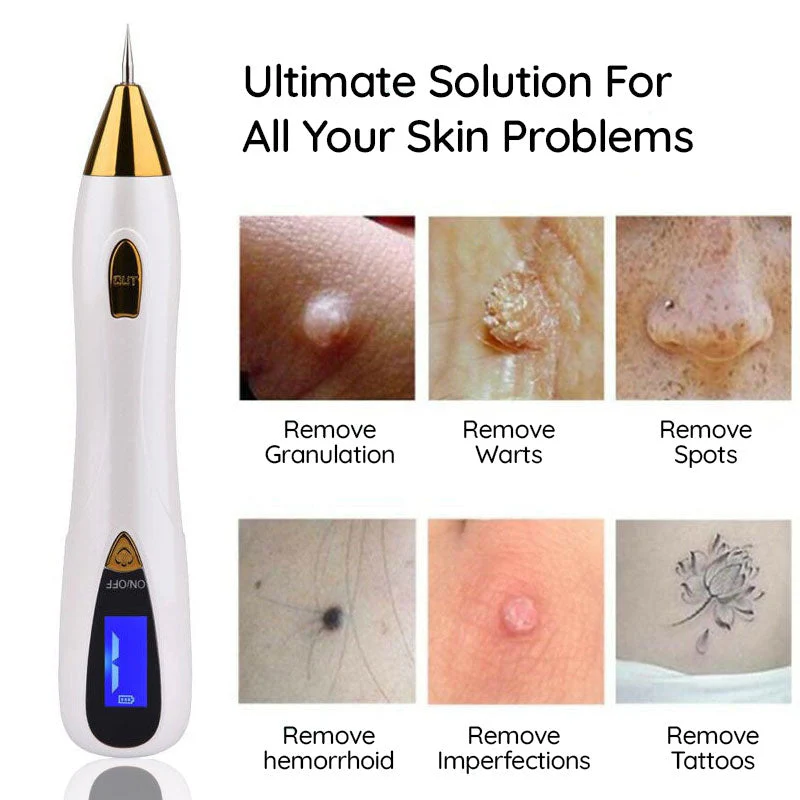 Mole Remover Pen At Home Skin Tag Removal Painless Fast - Image 5
