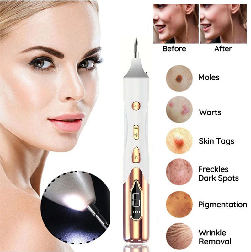Mole Remover Pen Home Skin Tag Removal Painless Safe - Image 2