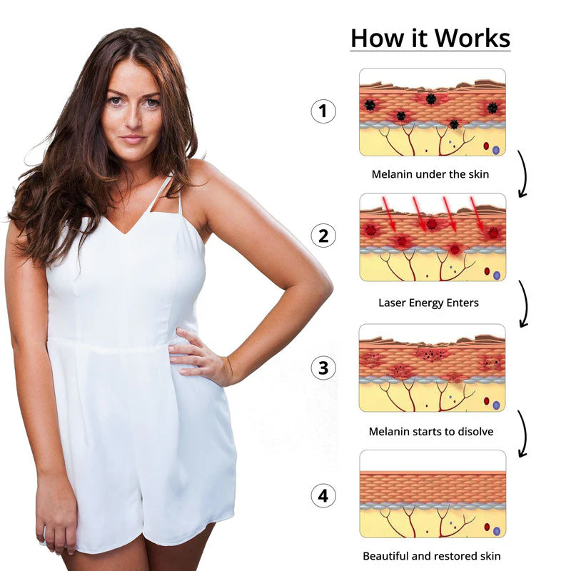 Picosecond Laser Pen Tattoo Removal Device Fast Safe - Image 4