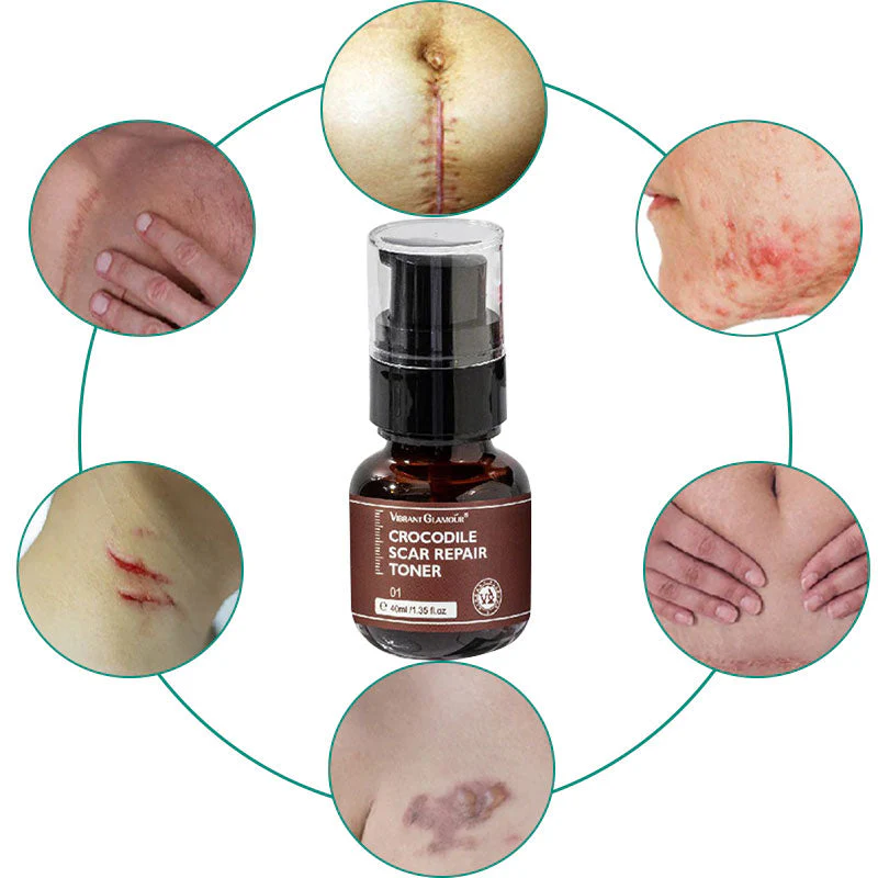 Scar Repair Toner Oil Free Vegan Skin Scar Reducer - Image 4