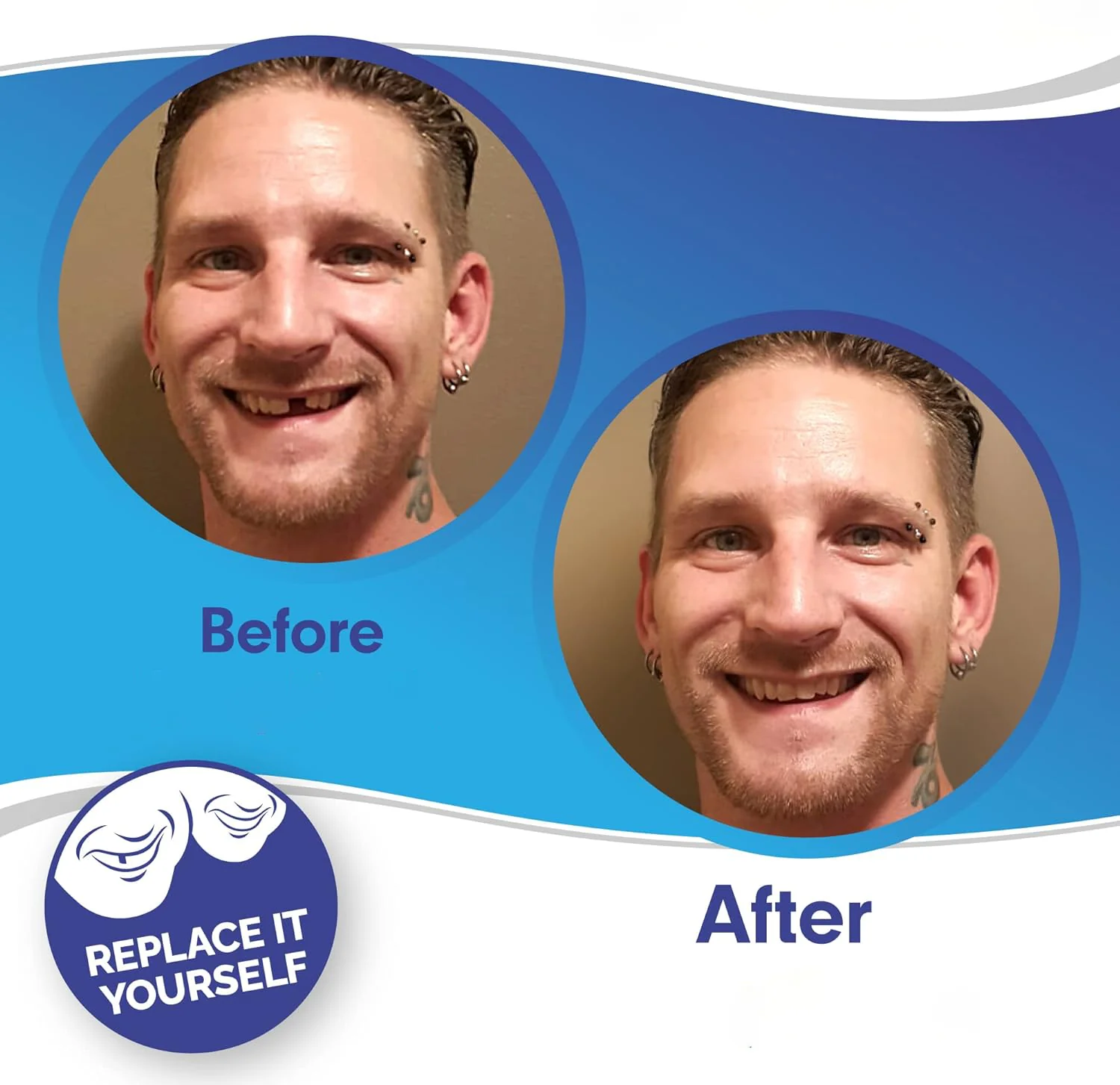 Smile Veneers Upper And Lower Instant Cover For All Day - Image 2