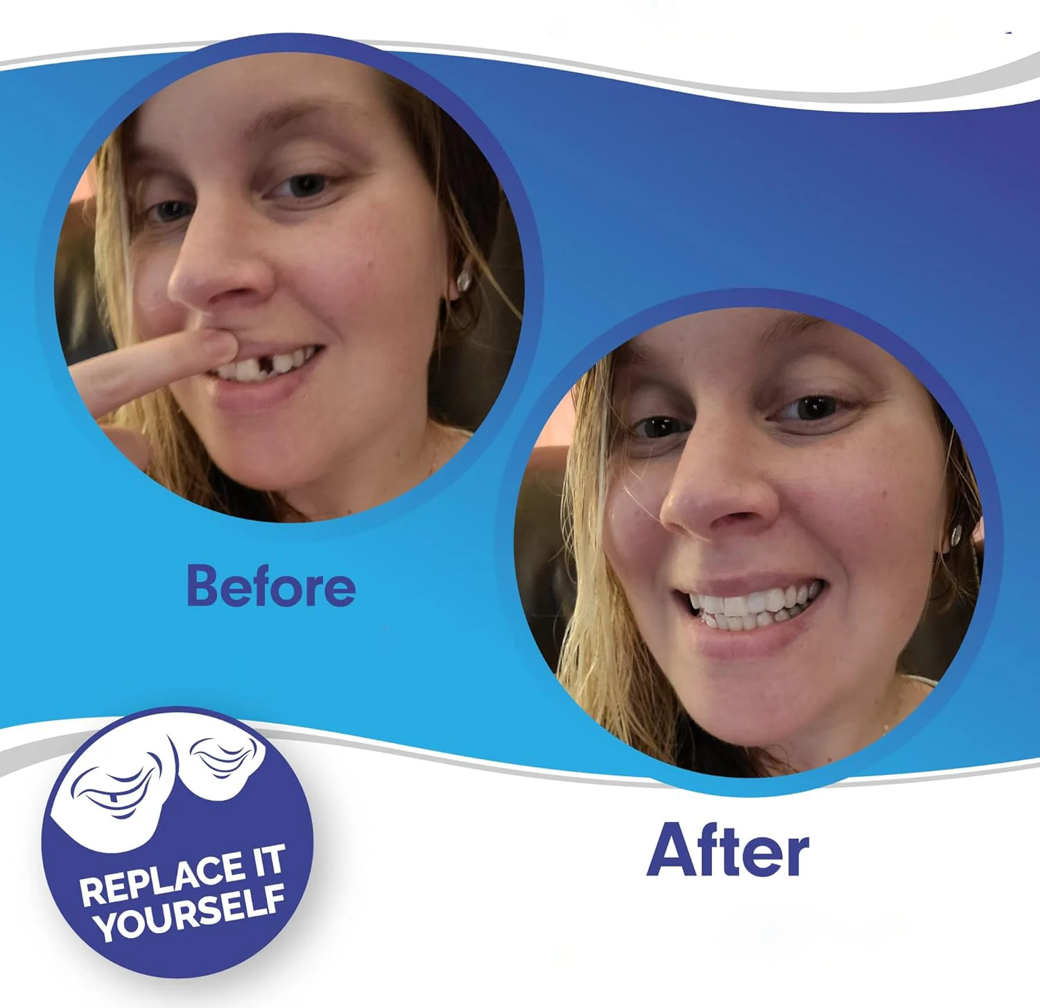 Smile Veneers Upper And Lower Instant Cover For All Day - Image 3