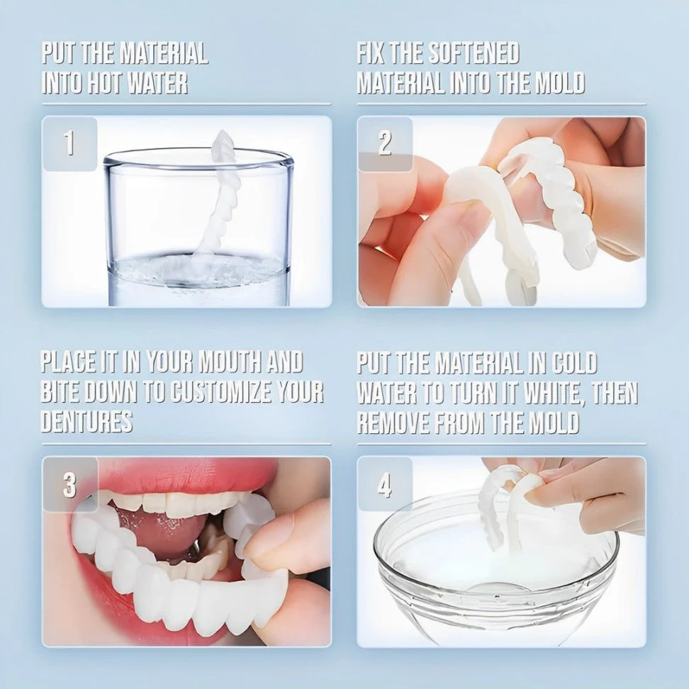 Smile Veneers Upper And Lower Instant Cover For All Day - Image 7