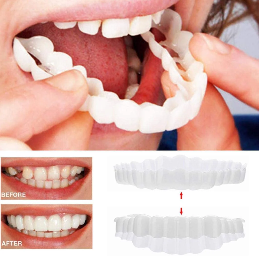 Smile Veneers Upper And Lower Instant Cover For All Day - Image 9