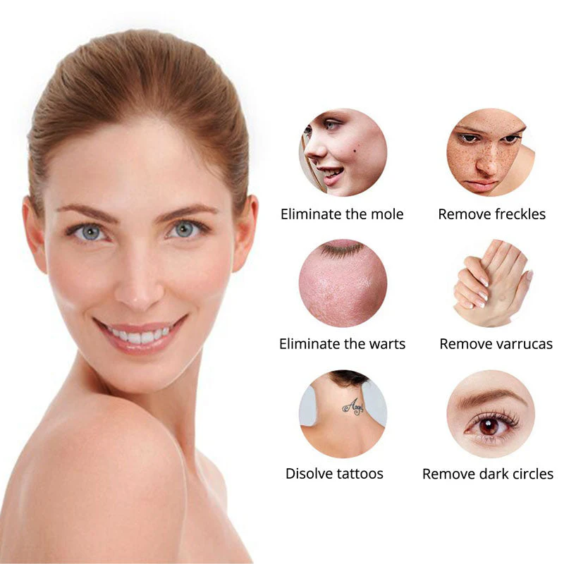 Tattoo Removal Laser Handheld Precision Smooth Skin - Image 2